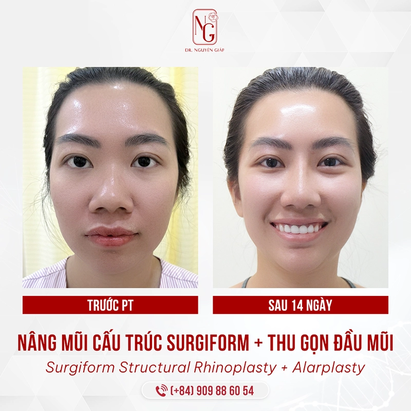 Thu gon canh mui B A 3