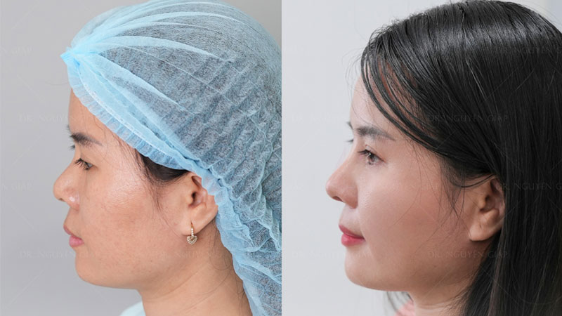 co-nen-nang-mui-khong