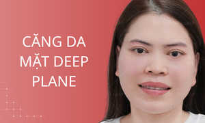dich-vu-cang-da-mat-deep-plane