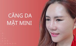 dich-vu-cang-da-mat-mini