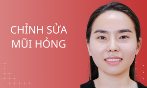 dich-vu-chinh-sua-mui-hong