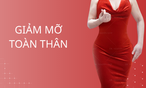 dich-vu-giam-mo-toan-than