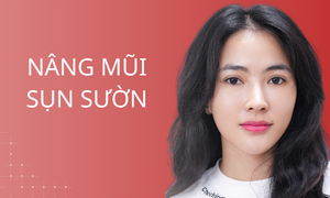dich-vu-nang-mui-sun-suon