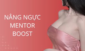 dich-vu-nang-nguc-mentor-boost