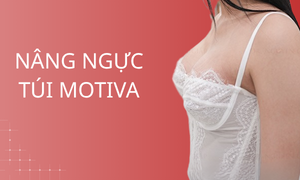 dich-vu-nang-nguc-tui-motiva