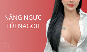dich-vu-nang-nguc-tui-nagor
