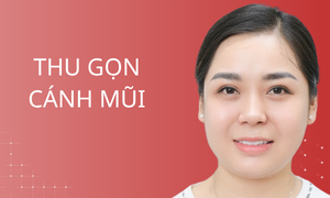 dich-vu-thu-gon-canh-mui