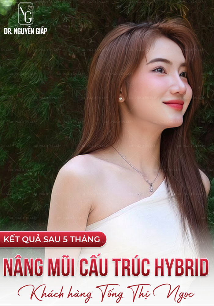 khach-hang-nang-mui-cau-truc