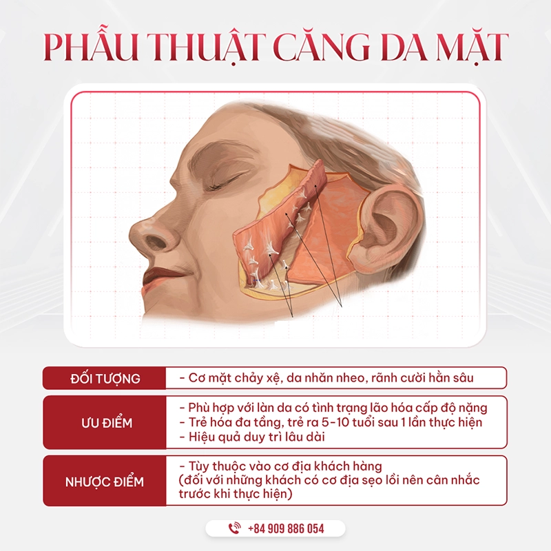 So sánh Căng da mặt Deep Plane và Căng da mặt bằng chỉ Phẫu thuật căng da mặt Deep Plane vượt trội hơn về hiệu quả trẻ hóa