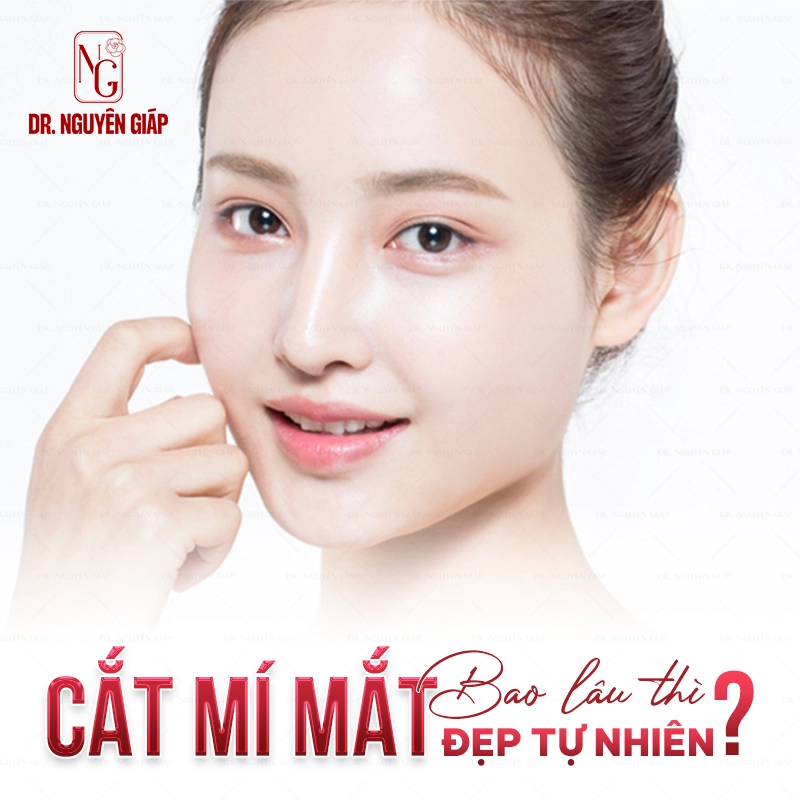 Cắt mí mắt bao lâu thì đẹp tự nhiên và hết sưng bầm?