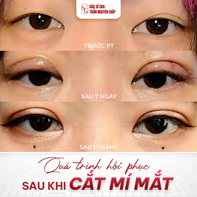 Cat mi mat