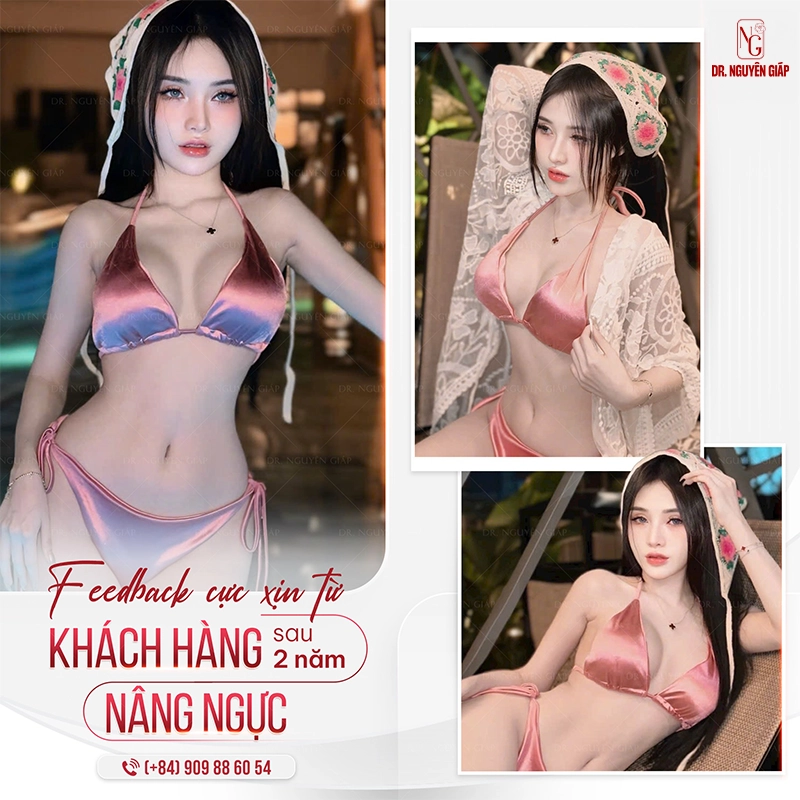 Dịch vụ Nâng ngực nội soi Nang nguc noi soi 1