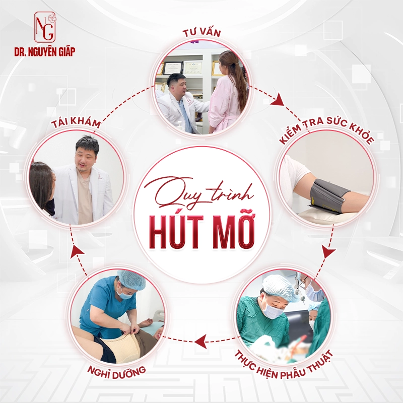 Hút mỡ Vaser 360- Kiến tạo vóc dáng và chuẩn mực an toàn quốc tế Quy trinh hut mo vaser 360