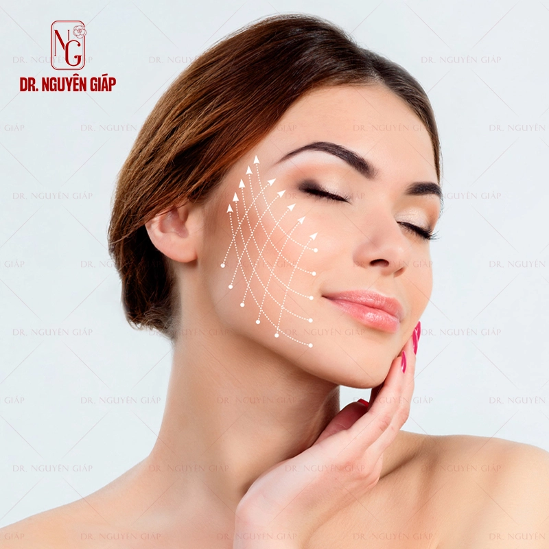 cang-chi-collagen-4 Căng chỉ collagen được yêu thích bởi khả năng trẻ hóa gương mặt