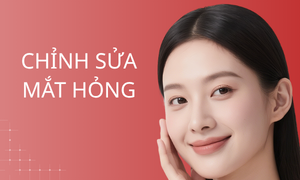 dich-vu-chinh-sua-mat-hong