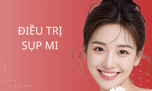 dich-vu-dieu-tri-sup-mi