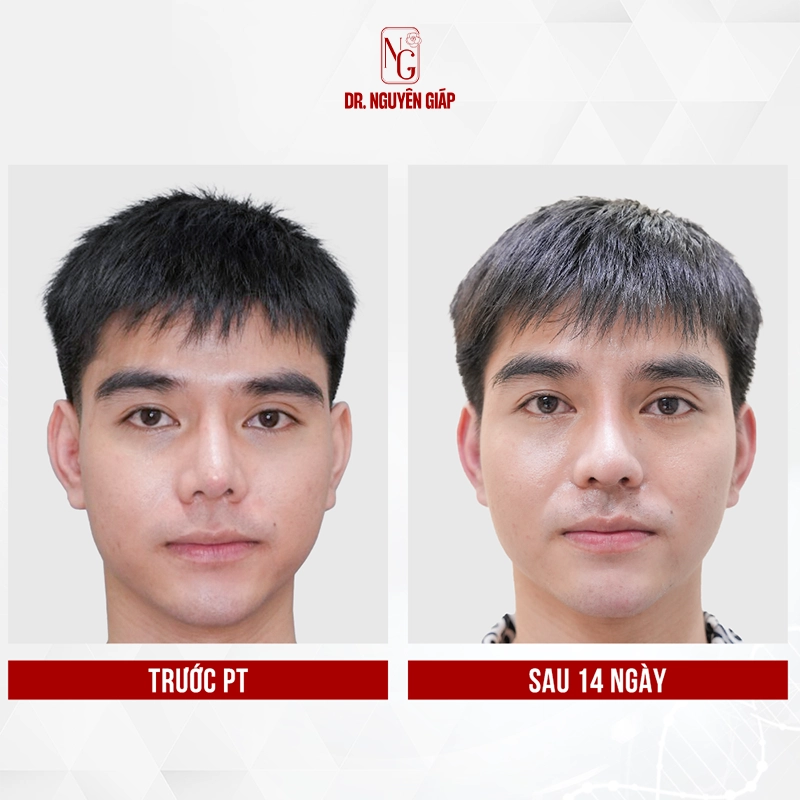 nang mui nam gioi 1