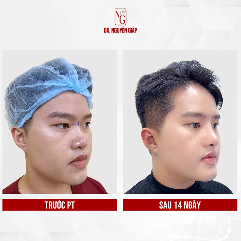 nang mui nam gioi 2