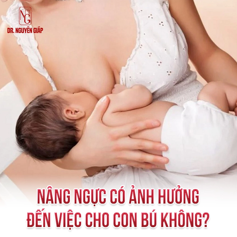 Nâng ngực có cho con bú được không?