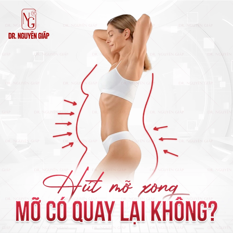 Hút mỡ xong mỡ có quay lại không