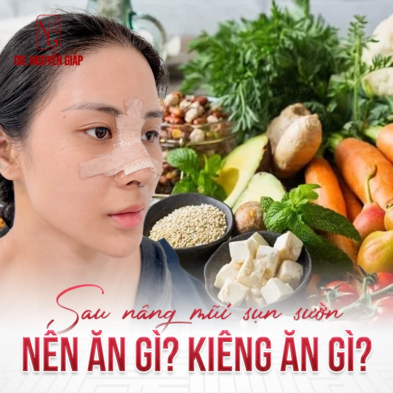 Hướng dẫn chăm sóc sau nâng mũi sụn sườn: Nên ăn gì và kiêng gì?