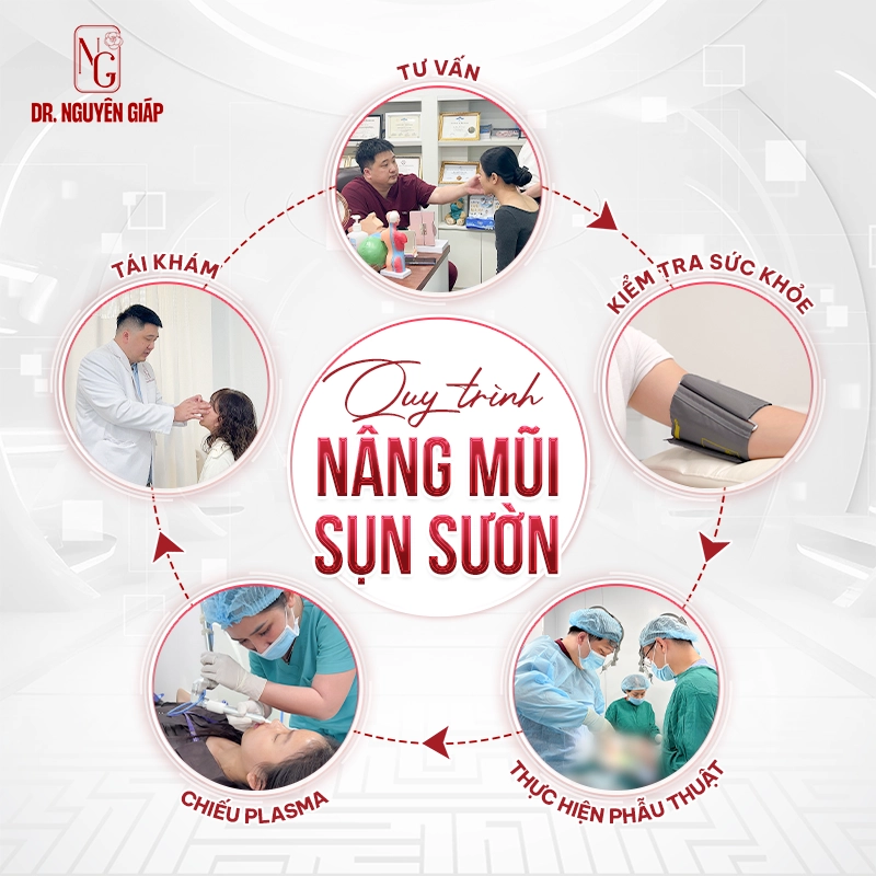 Nâng mũi sụn sườn là gì? Cẩm nang từ A-Z về phương pháp nâng mũi tự thân Quy trình nâng mũi sụn sườn tại Dr. Nguyên Giáp