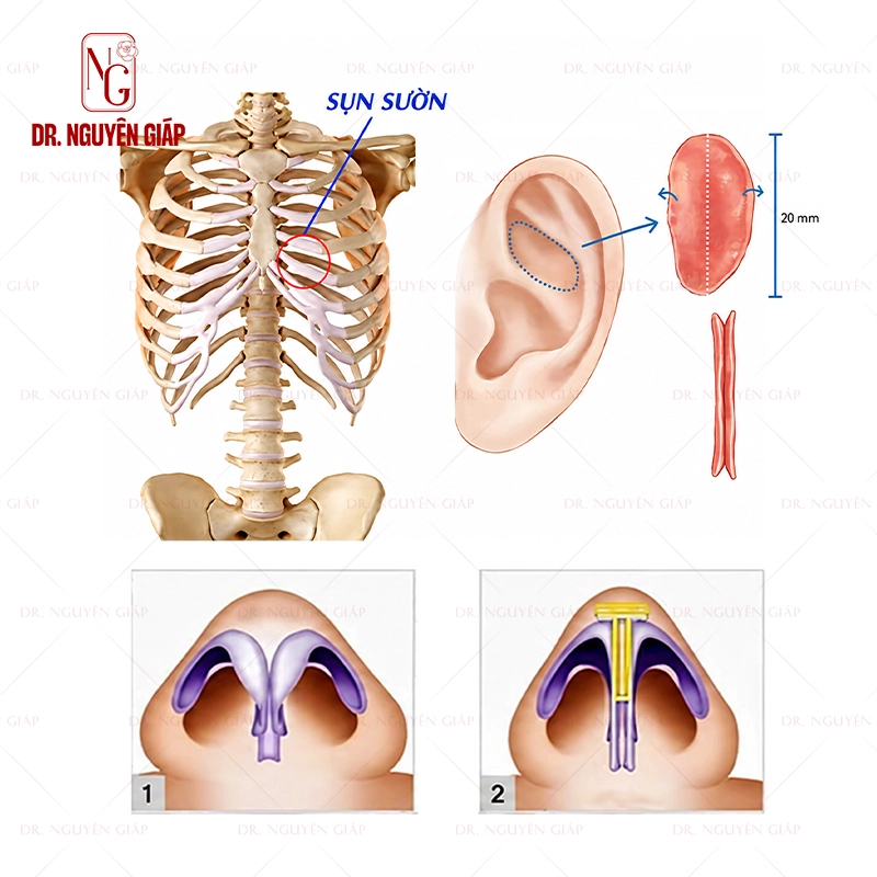 gia-nang-mui-sun-suon-3 Mỗi loại vật liệu có một mức chi phí khác nhau