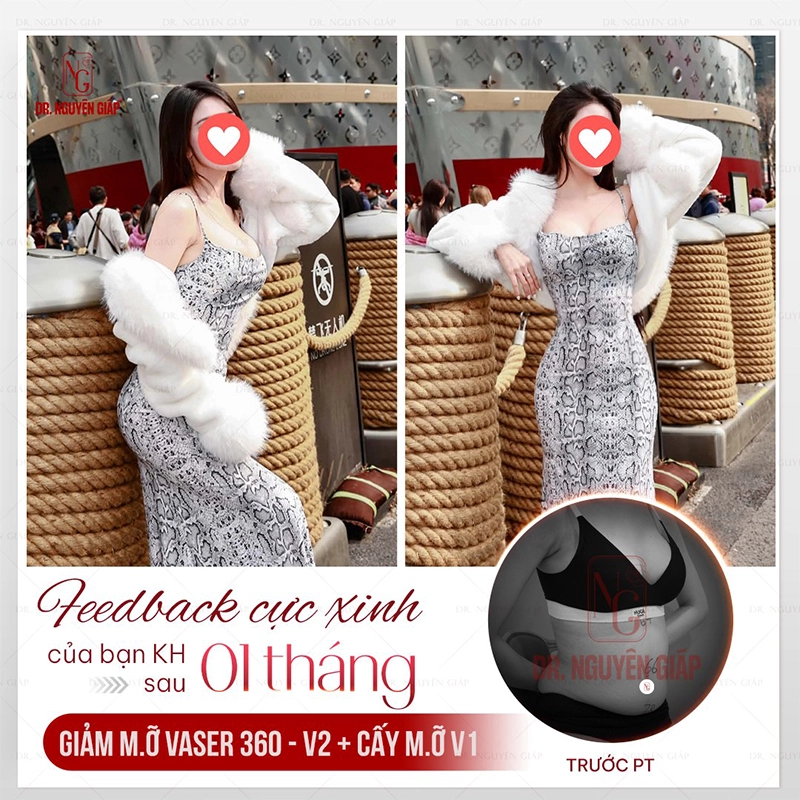 khach-hang-nang-nguc-va-cay-mo-1 Feedback siêu phẩm vòng 1 sexy, đẹp mọi góc độ cùng khách hàng Bác sĩ Nguyên Giáp
