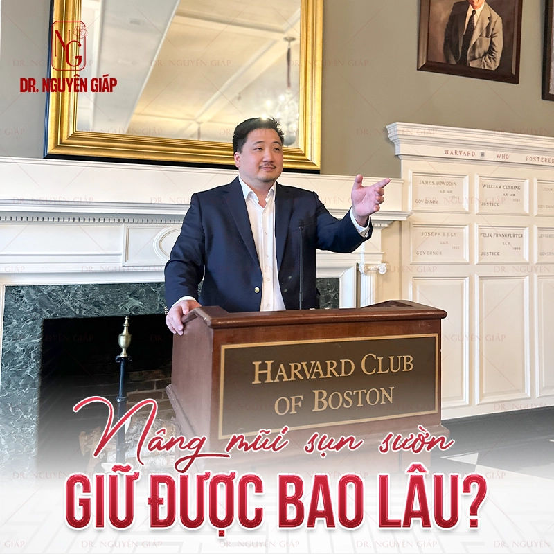 Nâng mũi sụn sườn giữ được bao lâu
