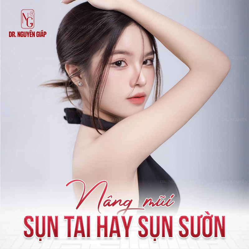 nâng mũi sụn tai hay sụn sườn