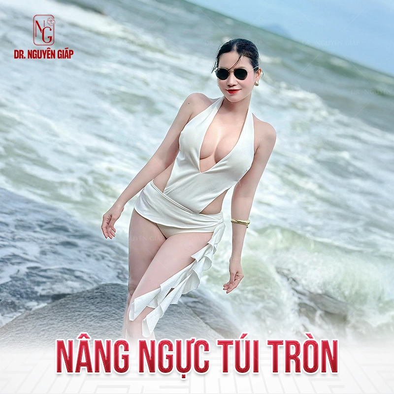 nang-nguc-tui-giot-nuoc-3 Nâng ngực túi tròn với độ nhô cao sexy