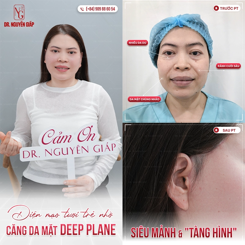 seo cang da mat mo han