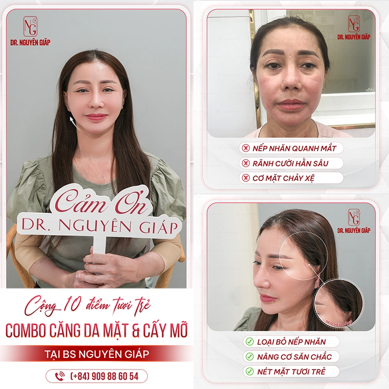 seo cang da mat sieu manh